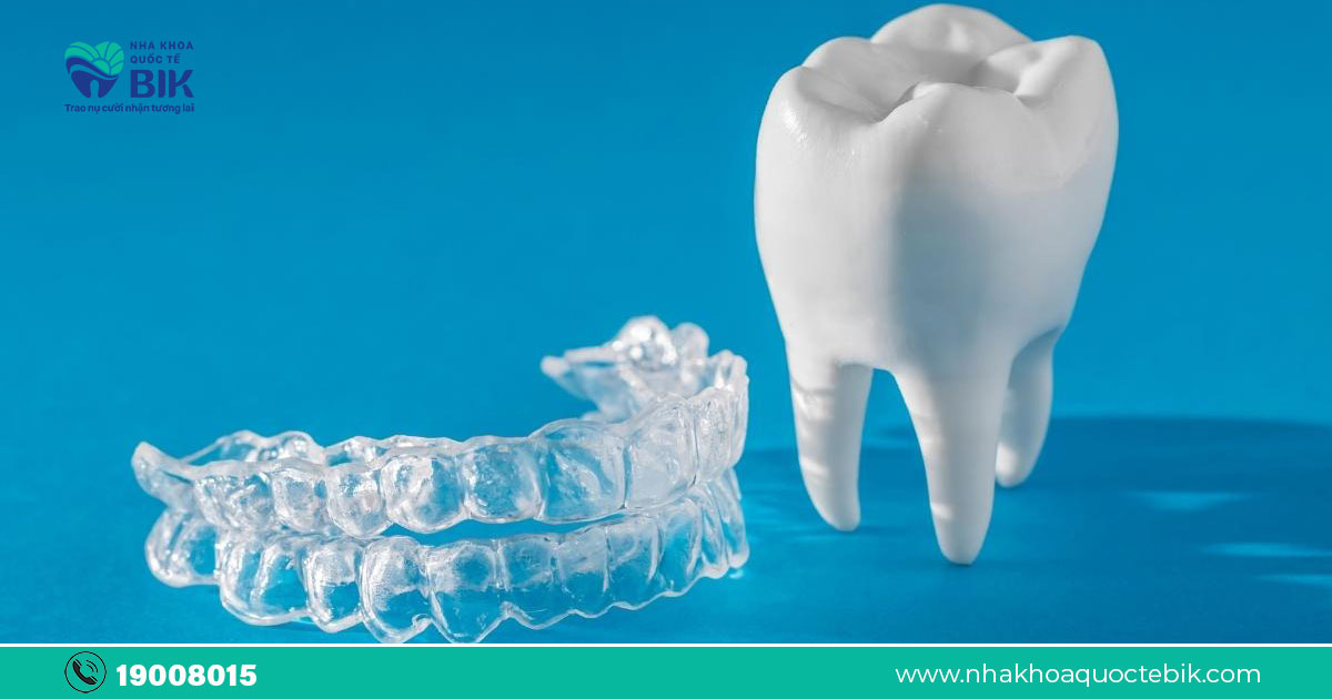 Có điều kiện nào cần tuân thủ khi sử dụng niềng răng trong suốt?
