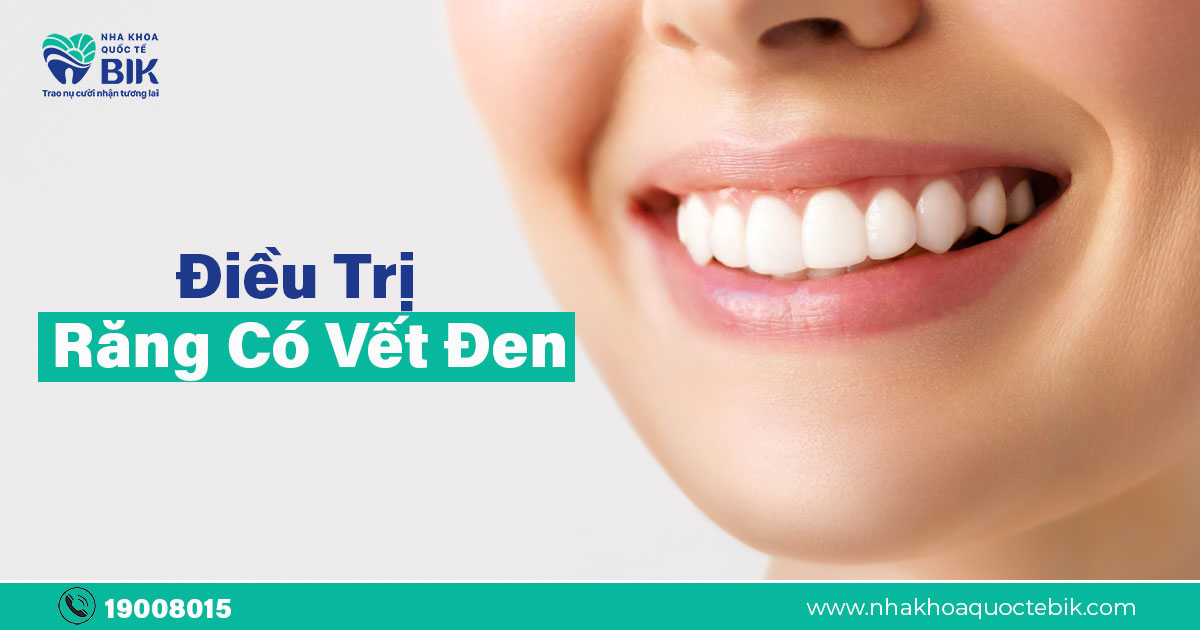 Vệ sinh răng miệng đúng cách có thể giúp ngăn ngừa răng bị vết đen không?
