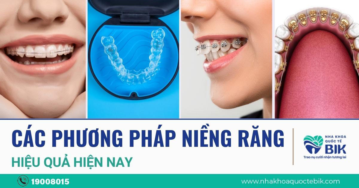 Ai là những người không thích hợp để niềng răng?