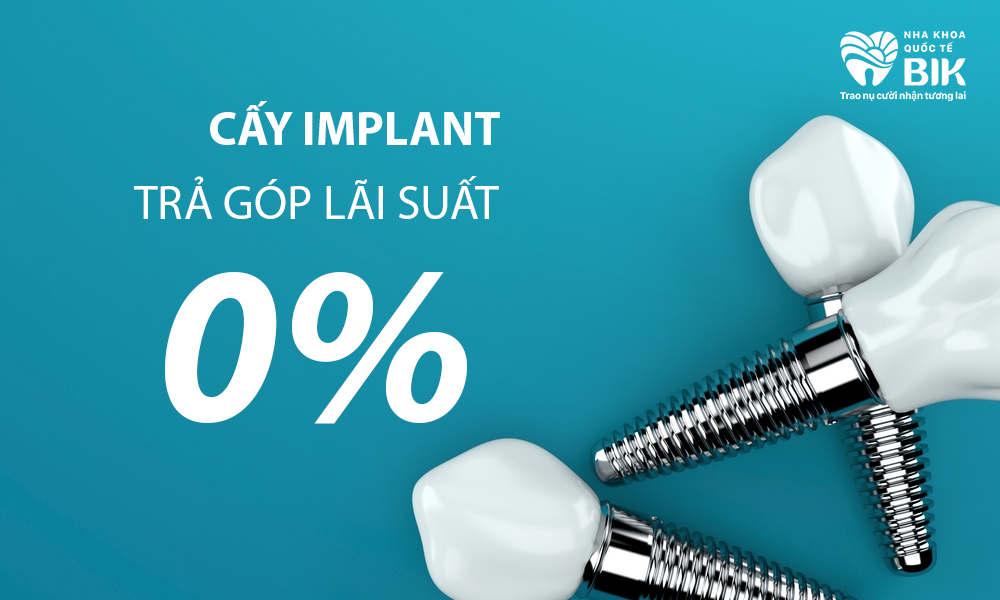 Cấy ghép implant trả góp với lãi suất 0%
