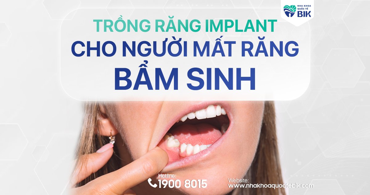 Trồng răng implant cho người mất răng bẩm sinh
