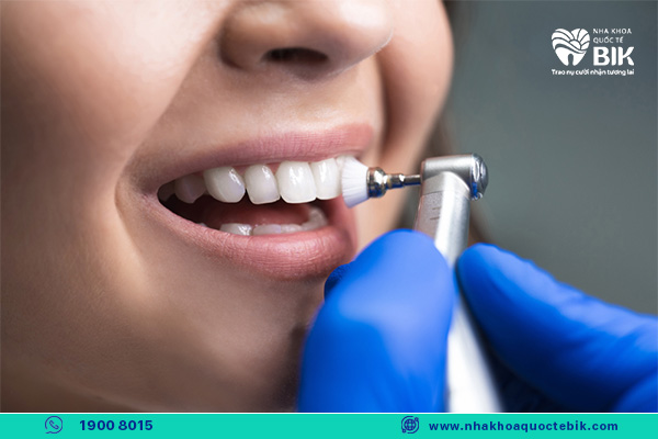 kiểm tra răng miệng định kỳ để răng sứ ổn định và bền