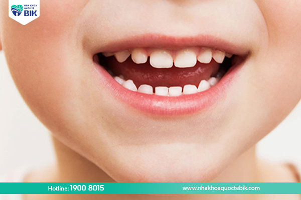 Trẻ em có bao nhiêu cái răng?