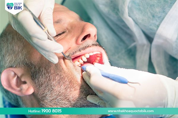 Nhổ răng cấm bị sâu có ảnh hưởng gì không