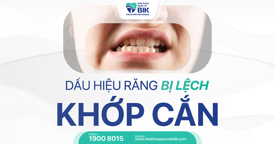 lech-khop-can