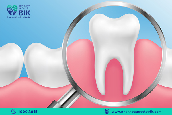 niềng răng hô hạn chế bệnh lý răng miệng
