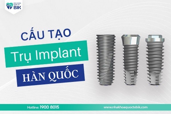 tru-rang-implant-han-quoc