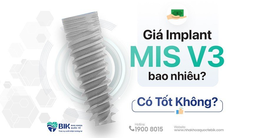 tru-implant-mis