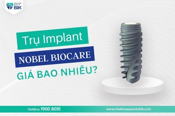 Mức giá trụ Implant Nobel Biocare bao nhiêu?