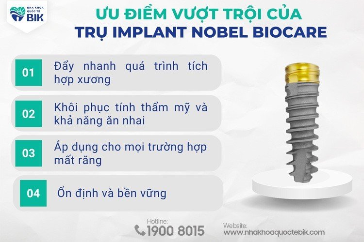 uu-diem-cua-tru-implant-nobel-biocare