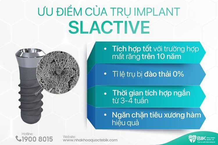 uu-diem-cua-tru-implant-slactive