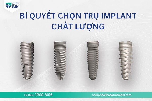 bi-quyet-chon-tru-implant-chat-luong