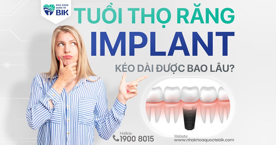 tuoi-tho-cua-rang-implant