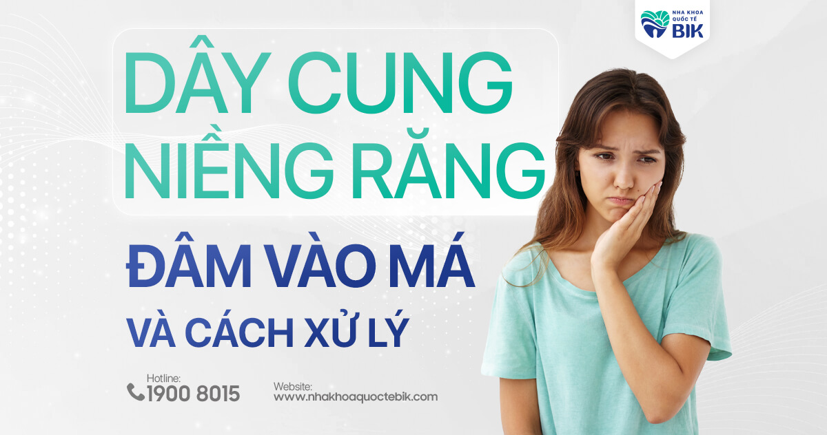 Dây cung niềng răng đâm vào má