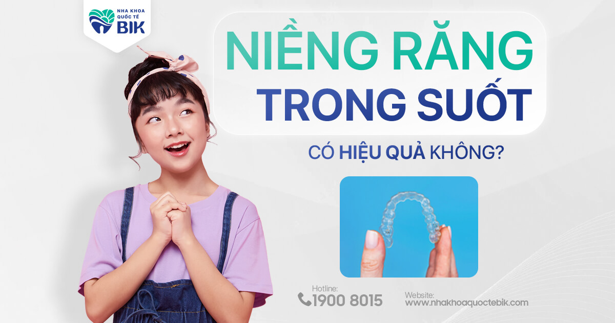 Niềng răng trong suốt là gì