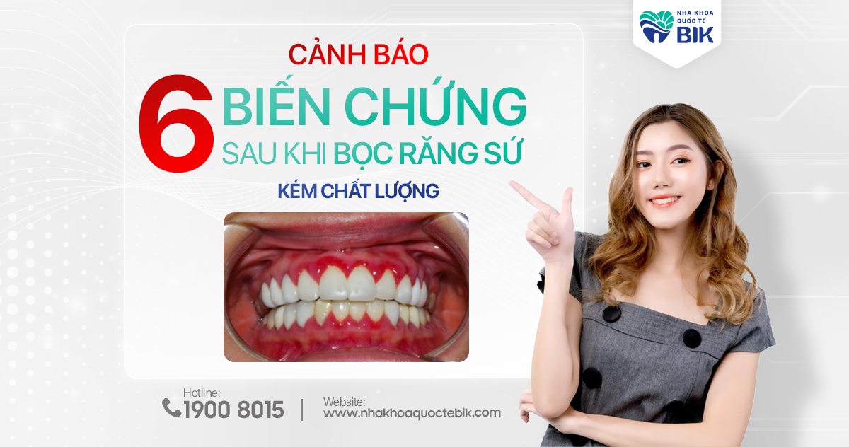 Cảnh báo_ 6 biến chứng sau khi bọc răng sứ kém chất lượng