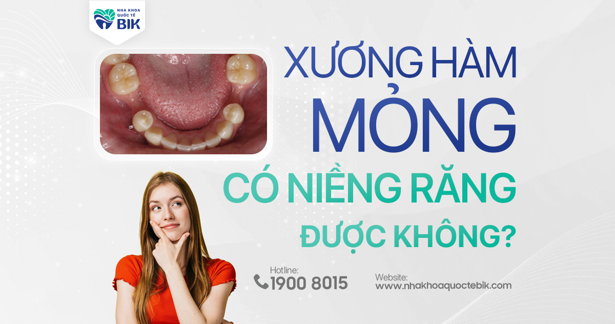 Xương hàm mỏng có niềng răng được không