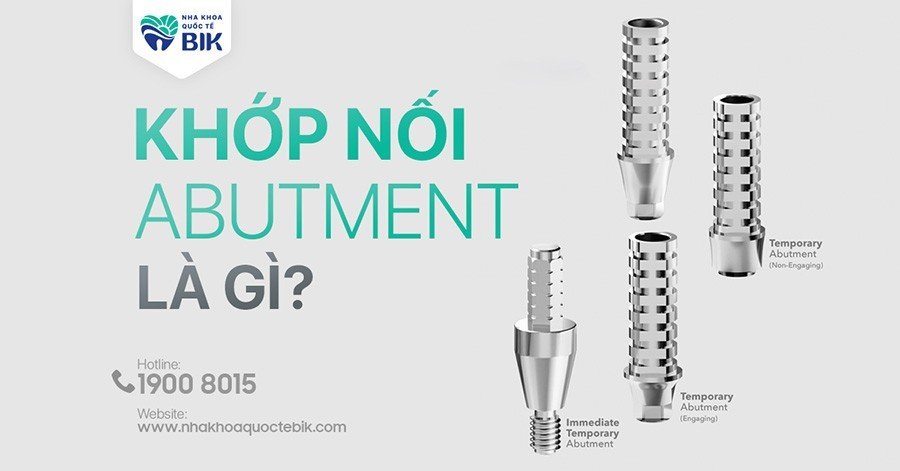 Abutment là gì? Đóng vai trò gì trong cấy ghép Implant?