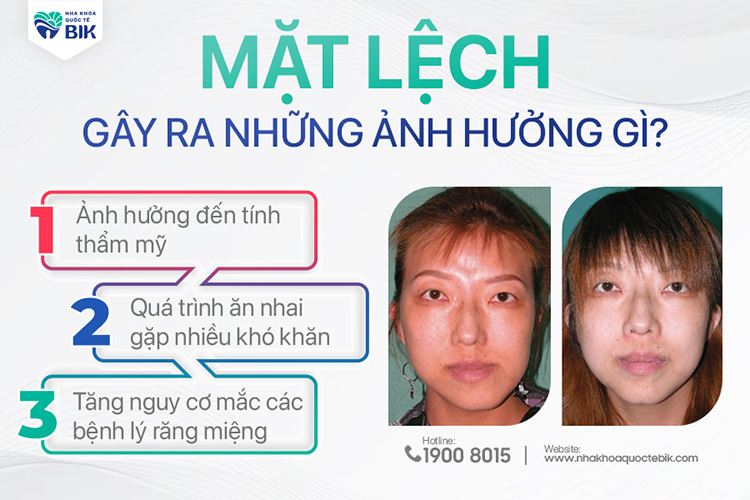 anh-huong-cua-mat-lech