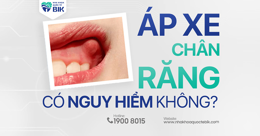 ap-xe-chan-rang-co-nguy-hiem-khong