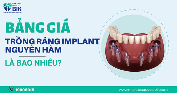 gia-trong-rang-implant-nguyen-ham