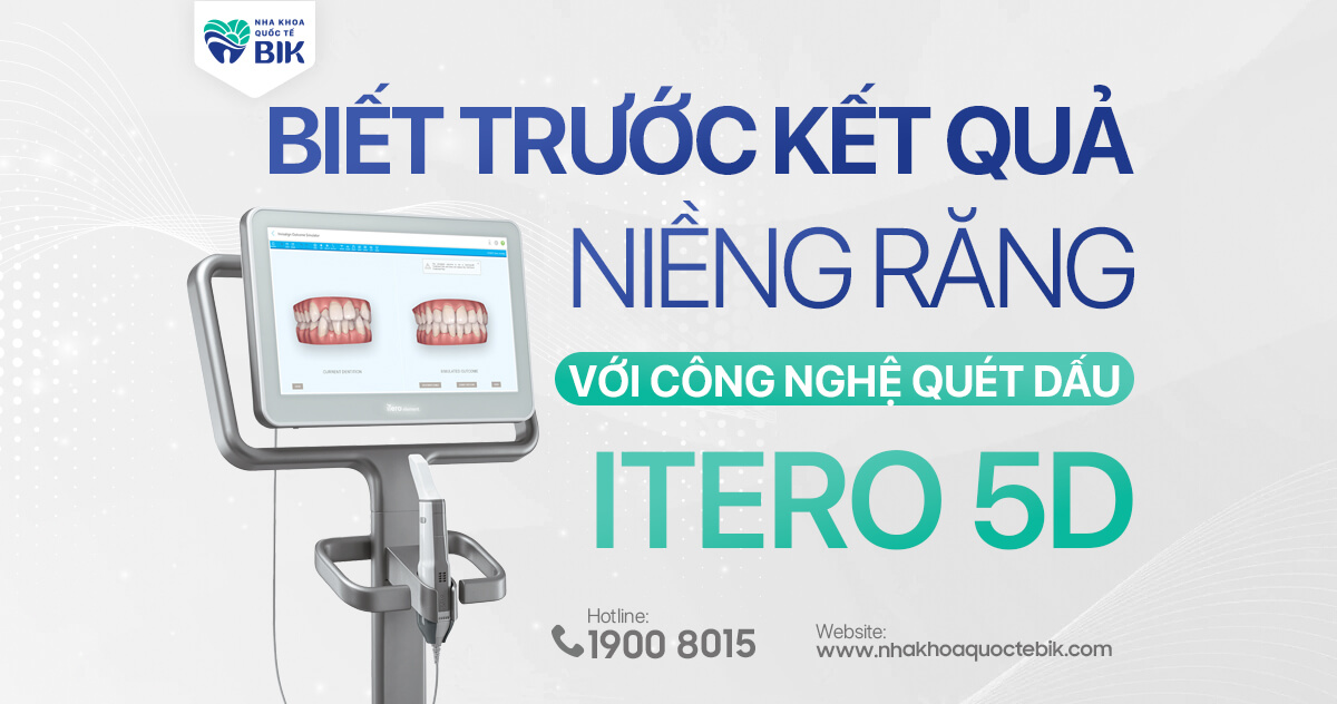 Biết trước kết quả niềng răng với công nghệ quét dấu itero 5D