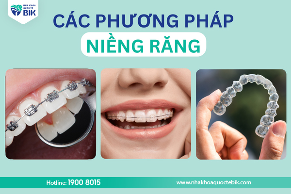 cac-phuong-phap-nieng-rang-hien-nay