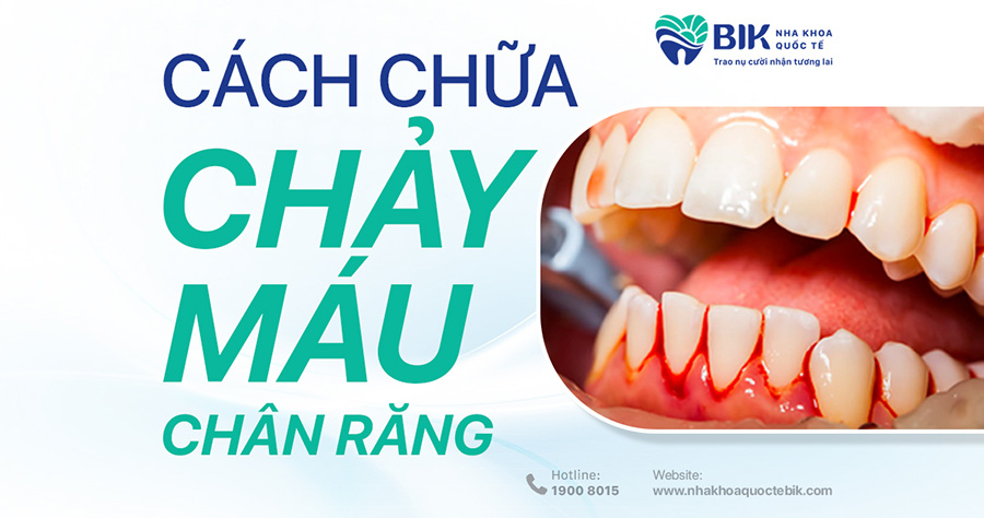 cach-chua-chay-mau-chan-rang-tai-nha