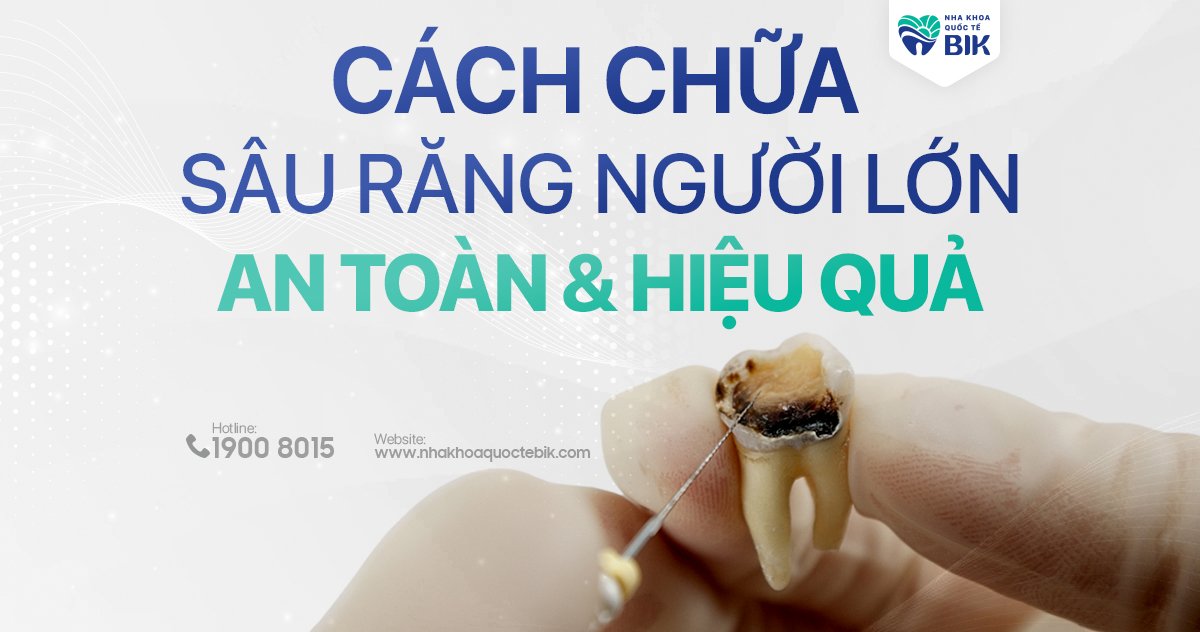 Cách chữa sâu răng người lớn