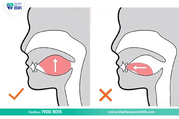 Cách khắc phục lệch mặt