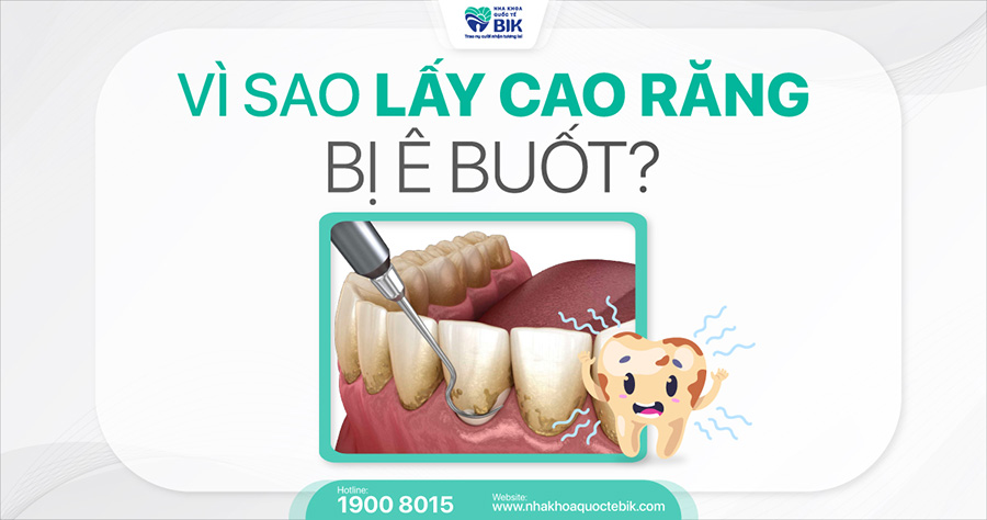 cao-voi-rang-bi-e-buot