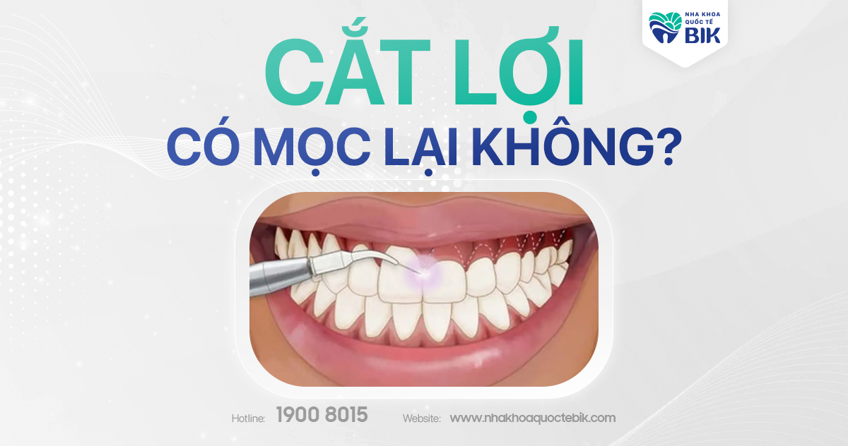 Cắt lợi có mọc lại không?