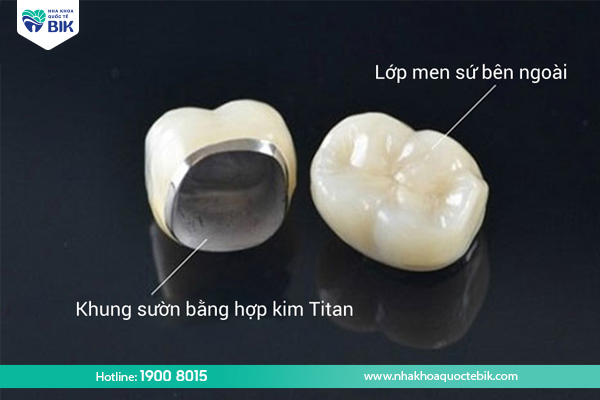 Titanium porcelain tooth structure