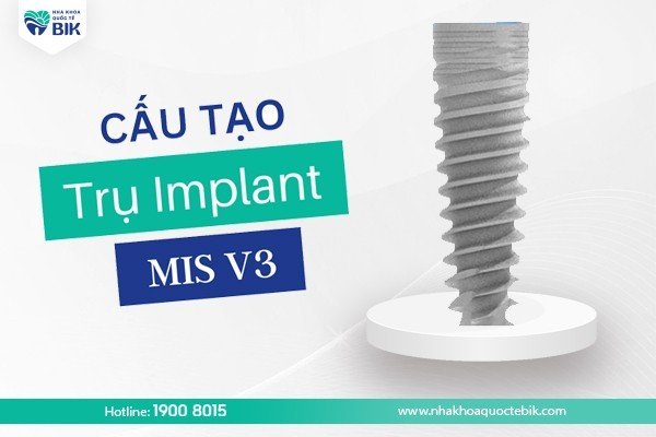 tru-implant-mis-v3