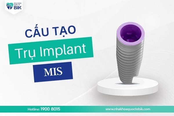 cau-tao-tru-implant-mis