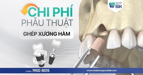 chi-phi-ghep-xuong-ham