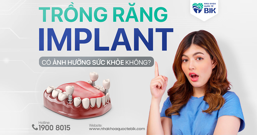 trong-rang-implant-co-anh-huong-suc-khoe-khong