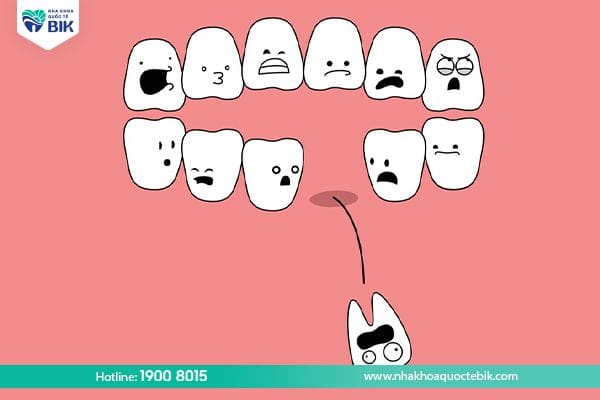 signs of severe tooth decay