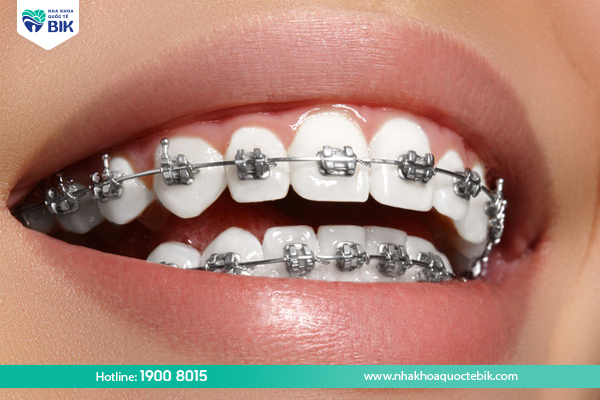 Orthodontic services