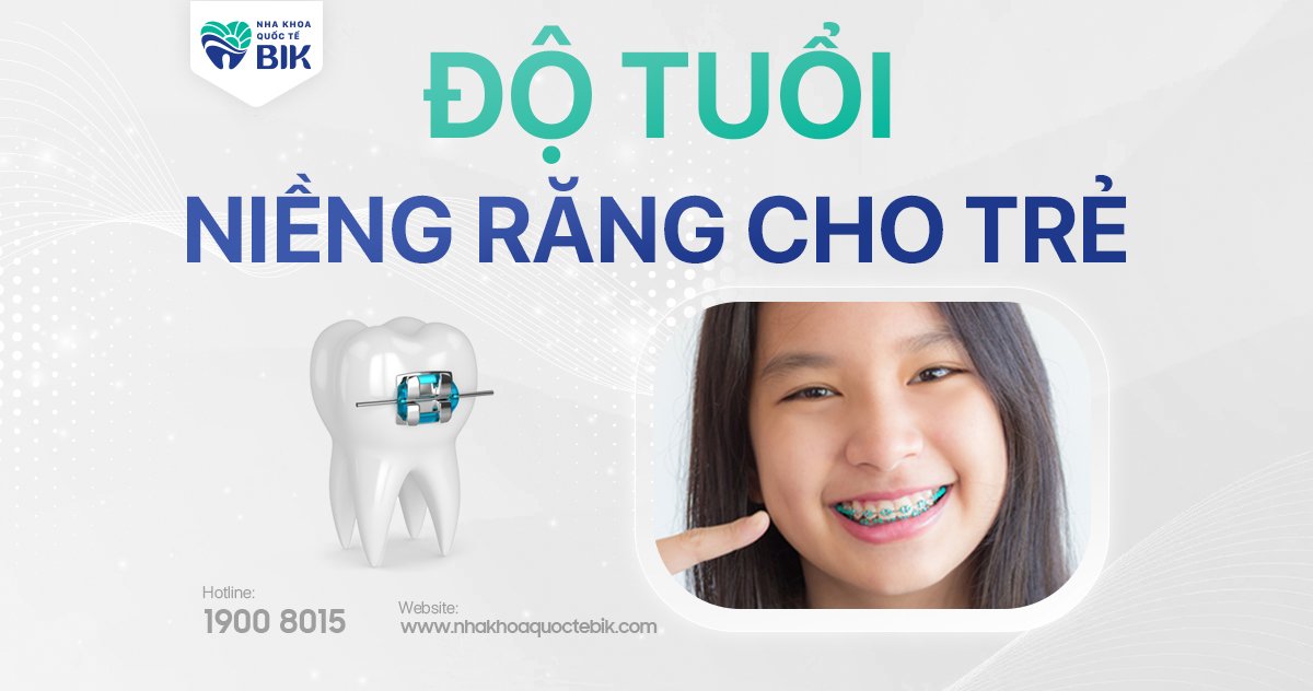 Độ tuổi niềng răng cho trẻ em