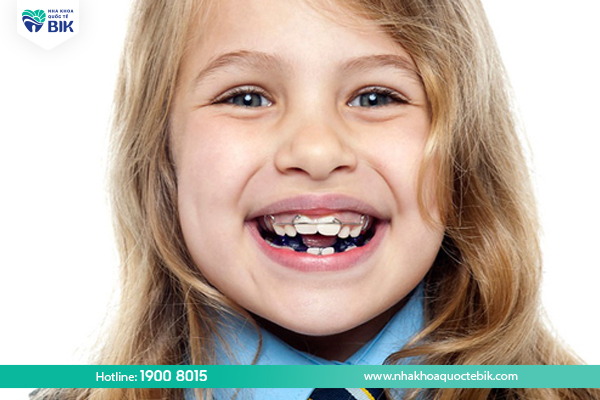 Age of braces for children