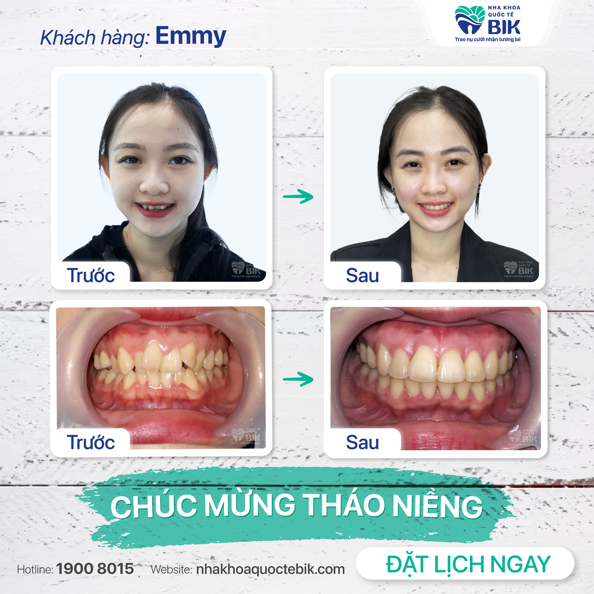 Khách hàng niềng răng tại BIK Dental