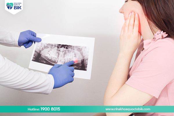 Wisdom tooth extraction price