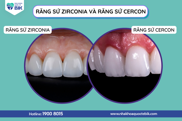 rang-su-zirconia-va-cercon