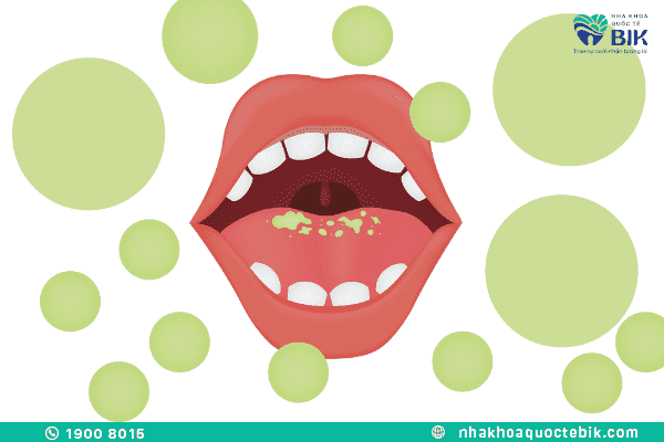 bad breath due to bacteria