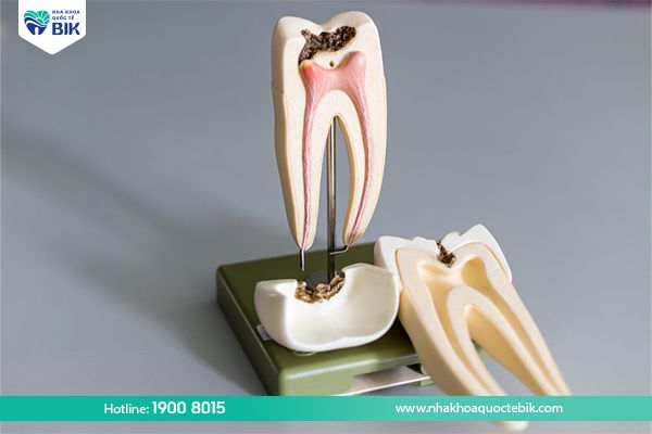 Root canal shape