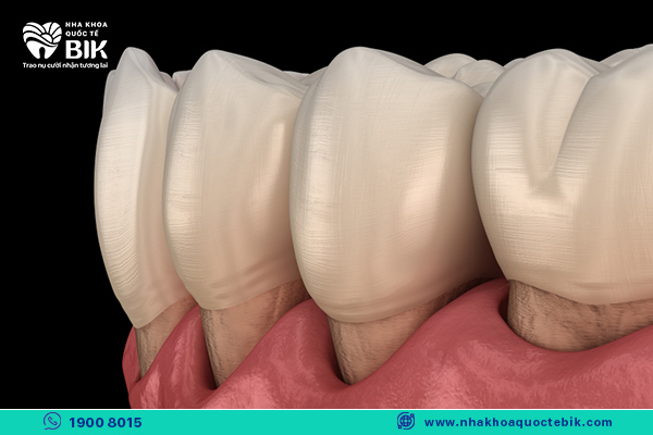 exposed tooth neck is a sign of dangerous porcelain crowns to health