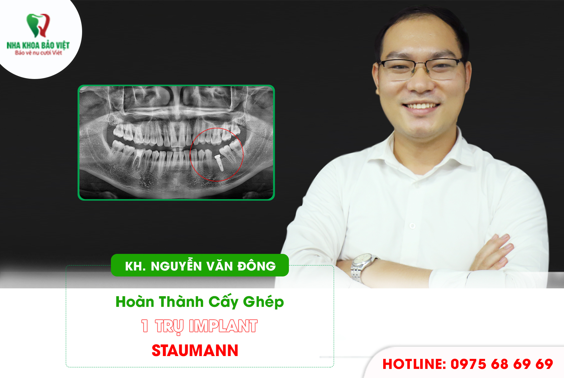 Khách hàng sau khi trồng răng implant