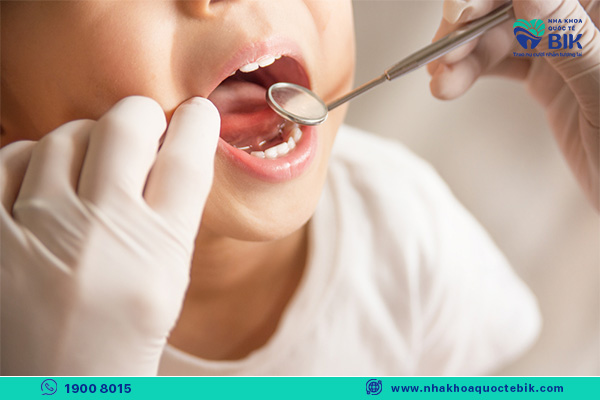 regular dental check-ups to prevent tooth decay in baby teeth