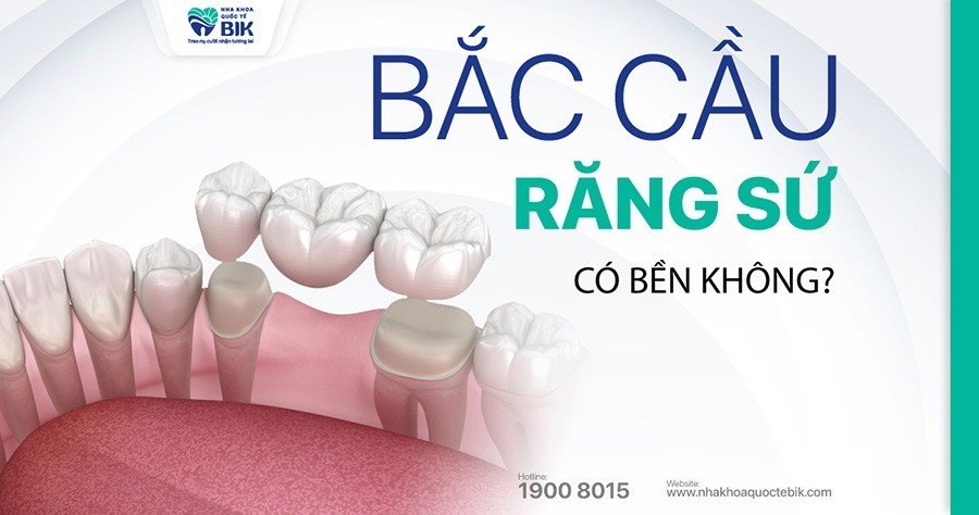 bac-cau-rang-su-co-ben-khong